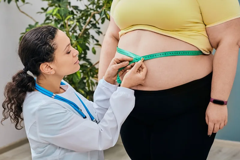 Manejo nutricional de sobrepeso y obesidad